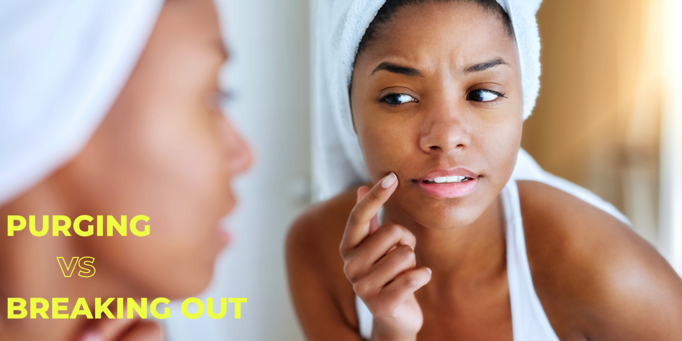 Are you purging or breaking out?