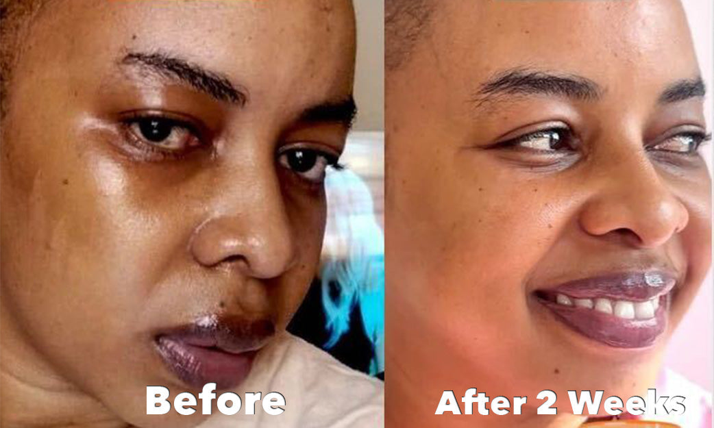 Before and After