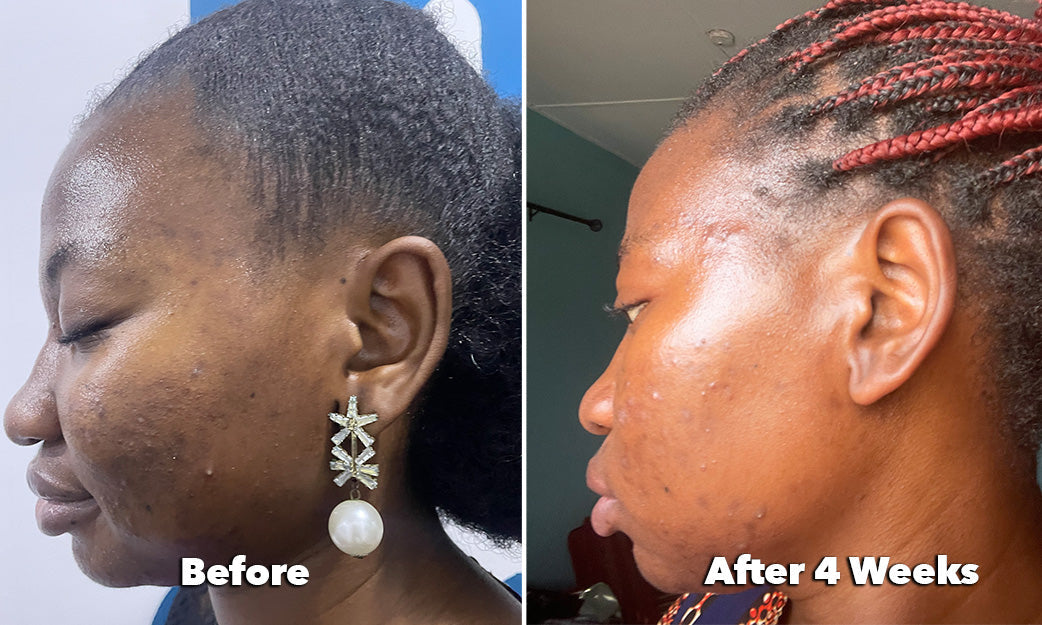 Before and After